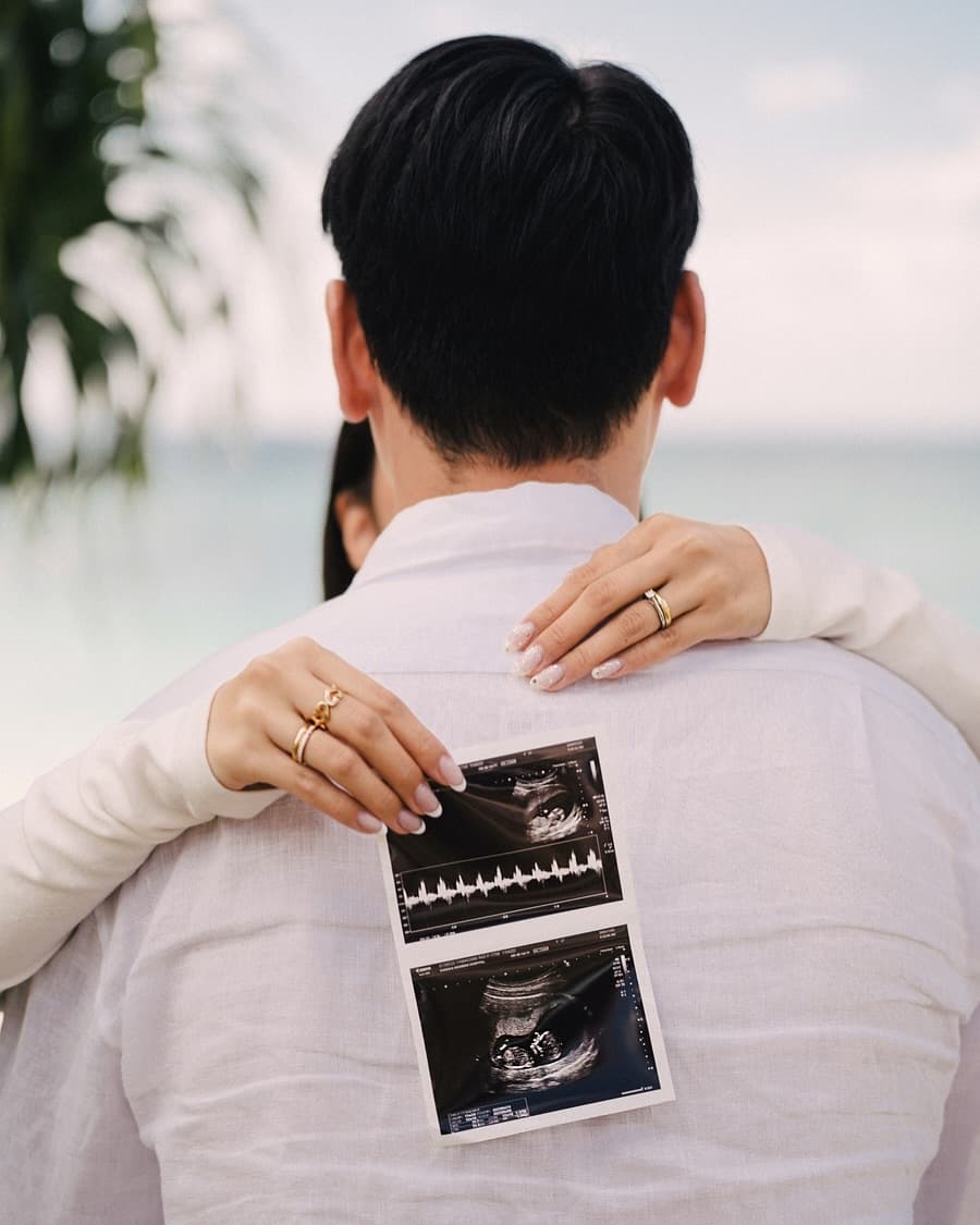 Wife's hands holding ultrasound photos against her husband's back by the Okinawa shore